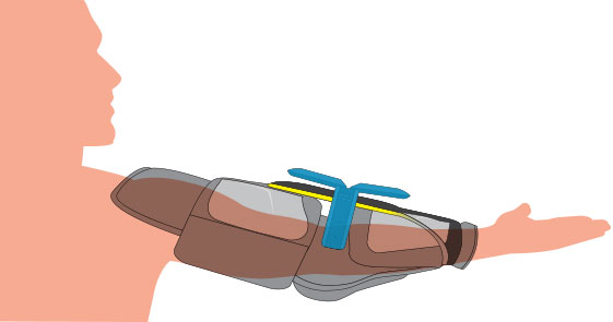 Axyflex System